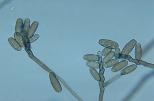 <strong>The following organism was isolated from an immunocompetent patient with chronic sinusitis.This organism is most likely: </strong> A)Mucor spp. B)Rhizopus spp. C)Alternaria spp. D)Curvularia spp.