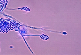 <strong>A patient who wears long-term contact lenses comes to her physician after noting a small spot on her cornea.Collection of the lesion for culture produced a fast-growing mold with a slight pink color on the surface.Microscopic review showed the following organism.This organism is most likely: </strong> A)Sporothrix schenckii. B)Fusarium spp. C)Mucor spp. D)Geotrichum spp.