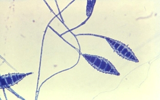<strong>A young boy develops itchy, dry scaly lesions on his leg with a raised, red, outer edge.A culture of the lesion reveals the following organism in a lactophenol cotton blue stain.This organism is most likely: </strong> A)Trichophyton spp. B)Mucor spp. C)Microsporum canis. D)Blastomyces dermatitidis.