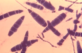 <strong>The following organism is isolated from a case of tinea capitis.The organism grew rapidly producing tan mold colonies.This organism is most likely: </strong> A)Trichophyton rubrum. B)Epidermophyton audouinii. C)Fonsecaea compacta. D)Microsporum gypseum.