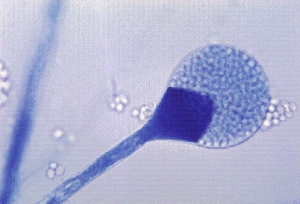 <strong>This organism was isolated from a diabetic patient with a sinus infection.The mold was extremely fast growing with a dirty white surface.Microscopic observation revealed wide aseptate hyphae without rhizoids.This organism is most likely: </strong> A)Mucor spp. B)Microsporum spp. C)Sporothrix schenckii. D)Malassezia furfur.