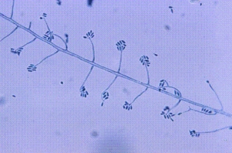<strong>A student working for the summer at a plant nursery has a nodular lesion on his forearm that develops a draining tract.The following organism is isolated from the culture at 22C.Identify the organism shown below. </strong> A)Trichosporon boydii B)Sporothrix schenckii C)Trichophyton rubrum D)Microsporum canis