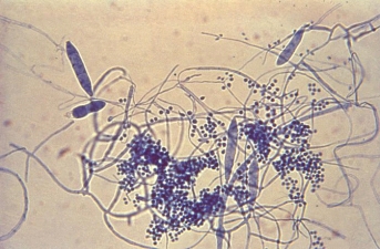 <strong>A patient with thickened and discolored nails was diagnosed with onychomycosis.A scraping of the nail was sent for culture.Microscopic analysis of the mold colony growth revealed the following morphology.The most likely identity of this organism is: </strong> A)Microsporum canis. B)Sporothrix schenckii. C)Aspergillus fumigatus. D)Trichophyton mentagrophytes.