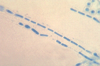 <strong>After returning from a vacation trip to the Amazon River delta in Brazil, a man notices a white dirtlike substance on his axilla hair that does not wash off in the shower.His health care provider samples the hairs and sends them to the laboratory for culture.Straw-colored yeastlike colonies show the following microscopic morphology.This is most consistent with an identification of: </strong> A)Malassezia furfur. B)Trichosporon spp. C)Microsporum audouinii. D)Trichophyton rubrum.