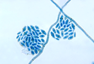 <strong>A young man notices a darkened area of skin on the palm of his hand.It seems to be increasing in size over the past 2 weeks.His health care provider collects a skin scraping for microscopic examination, which shows septate hyphal elements and budding cells.This organism is most likely: </strong> A)Malassezia furfur. B)Mucor spp. C)Hortaea werneckii. D)Microsporum canis.