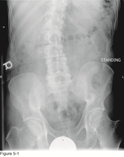 <strong> The majority of the pertinent findings in Figure 5-1 would be described in which paragraph of the radiology report?</strong> A)Alignment B)Bone C)Cartilage D)Soft tissue