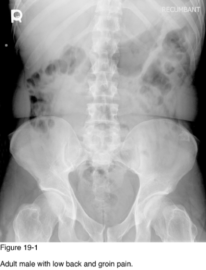 <strong> For what other areas of the skeleton should radiographic examination be considered to assess full extent of this patient's disease?</strong> A) Chest B) Knees and forearms C) Skull and sinuses D) Cervical and thoracic spine
