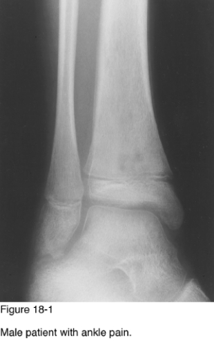 <strong> The location of the lesion and Figure 18-1 is best described as__________.</strong> A) Metaphyseal cortex B) Metaphyseal medullary cavity C) Epiphyseal cortex D) Intra-articular