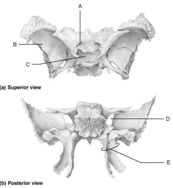 Figure 7.2 Using Figure 7.2, match the following: Allow cranial nerves that control eye movements to enter the orbit.
