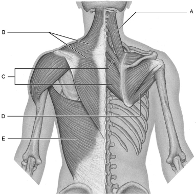 Figure 10.3 Using Figure 10.3, match the following: The latissimus dorsi.