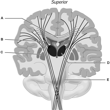 Figure 12.2 Using Figure 12.2, match the following: Pons.