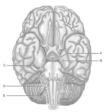 Figure 13.1 Using Figure 13.1, match the following: -Damage to this nerve would keep the eye from rotating inferolaterally.