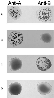 Figure 16.2 Using Figure 16.2, match the following: Type B.