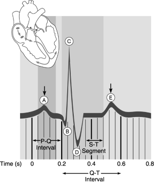 Figure 17.2 Using Figure 17.2, match the following: Ventricular repolarization.