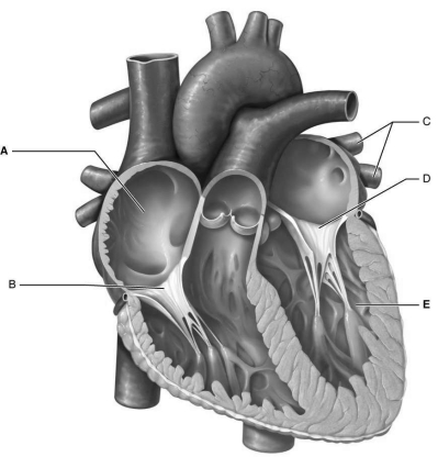 Figure 17.4 Using Figure 17.4, match the following: Right atrium.