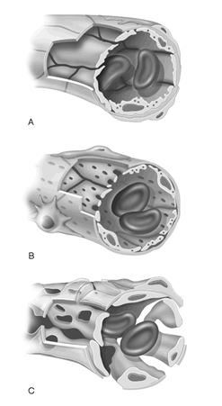 Figure 18.1 Using Figure 18.1, match the following: Capillary found in endocrine organs that allows hormones to gain rapid entry into the blood.