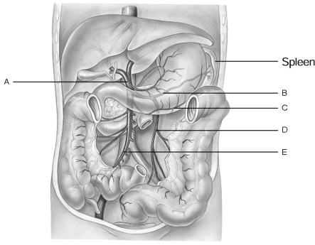 Figure 18.2 Using Figure 18.2, match the following: Inferior mesenteric vein.