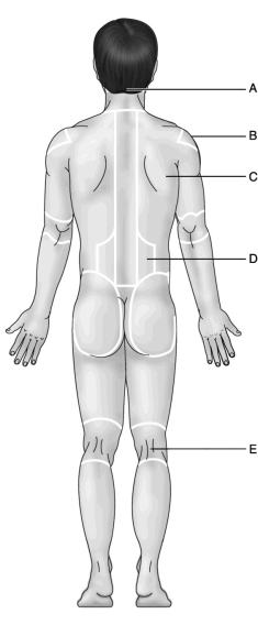 <strong>Figure 1.2 Use the diagram above to answer the following questions. Which letter indicates the scapular region?</strong> A) A B) B C) C D) D E) E