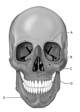 <strong> Figure 7.1 Use the diagram above to answer the following questions. Which letter indicates the facial bone that has as inferior orbital fissure?</strong> A) A B) B C) C D) D E) E