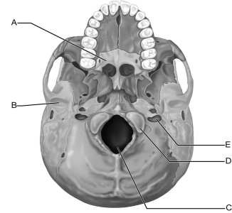 <strong> Figure 7.3 Use the diagram above to answer the following questions. Which letter indicates the palatine bone that forms part of the hard palate?</strong> A) A B) B C) C D) D E) E