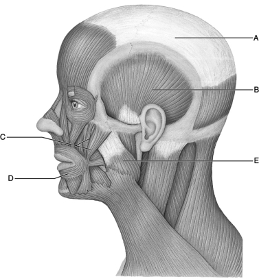 <strong> Figure 11.2 Use the diagram above to answer the following questions. Identify the letter that indicates the Temporalis.</strong> A) A B) B C) C D) D E) E