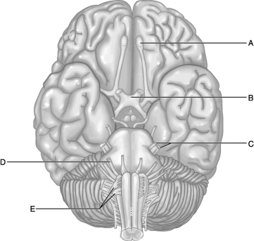 <strong> Figure 14.2 Use the diagram above to answer the following questions. Which cranial nerve, along with the abducens and oculomotor nerves, has somatic motor fibers that pass through the superior orbital fissure?</strong> A) I B) II C) IV D) VII E) VIII