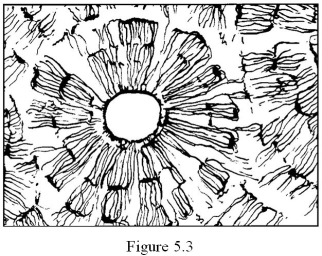 <strong> The arrangement of bone tissue shown in Figure 5.3 consists of ________.</strong> A) osteons (Haversian systems) B) yellow marrow C) trabeculae D) neurons E) red marrow
