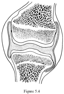 <strong> The type of joint shown in Figure 5.4 is ________.</strong> A) a suture B) a fibrous joint C) an amphiarthrotic joint D) a cartilaginous joint E) a synovial joint