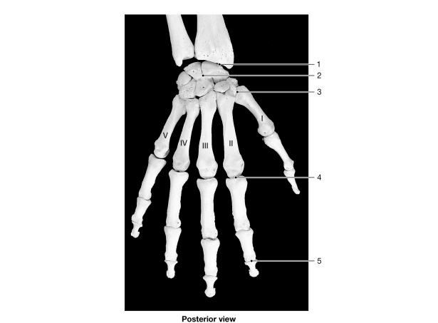 <strong>  Figure 8- 1 Bones of the Wrist and Hand Use Figure 8- 1 to answer the following questions: Identify the type of joint at label 3.</strong> A) hinge B) saddle C) pivot D) ellipsoid E) gliding <div style=padding-top: 35px> 