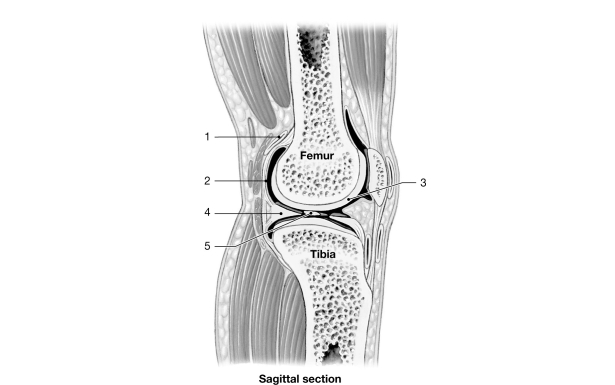 <strong>  Figure 8- 2 A Simplified Sectional View of the Knee Joint Use Figure 8- 2 to answer the following questions: Identify the structure labeled 2.</strong> A) synovial membrane B) periosteum C) serous membrane D) joint capsule E) intracapsular ligament <div style=padding-top: 35px> 