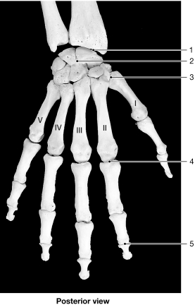 <strong>  Figure 8- 1 Bones of the Wrist and Hand Use Figure 8- 1 to answer the following questions: Identify the type of joint at label 4.</strong> A) pivot B) hinge C) gliding D) saddle E) ellipsoid <div style=padding-top: 35px> 