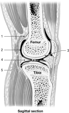 <strong>  Figure 8- 2 A Simplified Sectional View of the Knee Joint Use Figure 8- 2 to answer the following questions: The ankle joint is an example of an) joint.</strong> A) hinge B) ellipsoid C) gliding D) saddle E) ball- and- socket <div style=padding-top: 35px> 