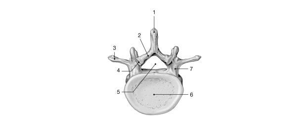 <strong> Figure 7- 2 Typical Vertebra inferior view) Use Figure 7- 2 to answer the following questions: Identify the structure labeled 2.</strong> A) transverse process B) superior articular process C) lamina D) inferior articular process E) pedicle