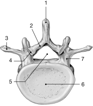 <strong> Figure 7- 2 Typical Vertebra inferior view) Use Figure 7- 2 to answer the following questions: Identify the structure labeled 1.</strong> A) spinous process B) transverse articular facet C) pedicle D) lamina E) transverse process