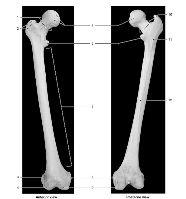   Figure 7- 6 The Femur Use Figure 7- 6 to answer the following questions: -The hypophyseal fossa of the sella turcica contains the _______gland.