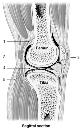 Figure 8-1 -What type of tissue occurs at the structure labeled 3?