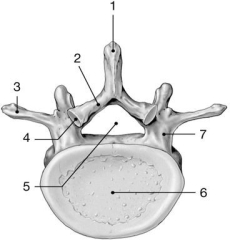 <strong> Figure 7-2 -Identify the structure labeled 1.</strong> A)pedicle B)transverse process C)lamina D)spinous process E)transverse articular facet