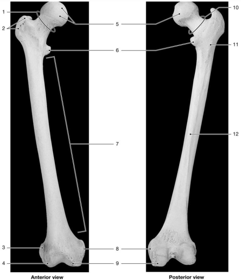   Figure 7-5 -Identify the structure labeled 12.