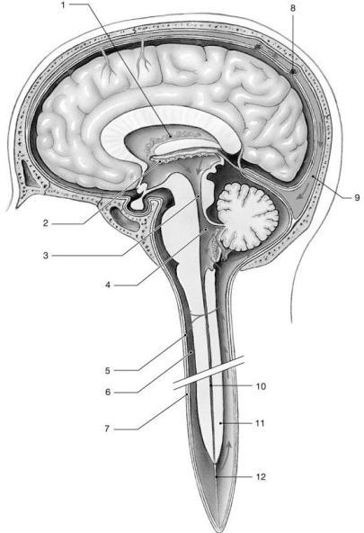   Figure 13-1 -Identify the structure labeled 3.