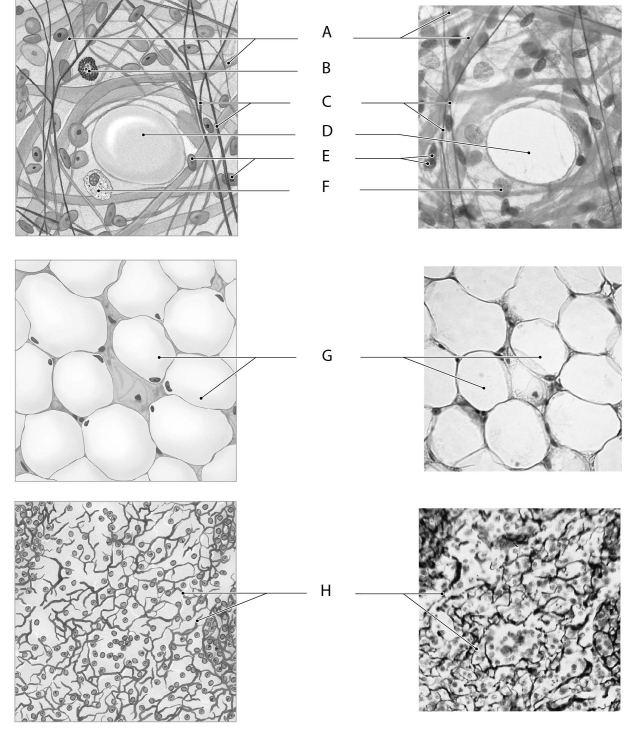 Figure 3.3     Using the figure above, identify the labeled part. -Label F: ______________________________
