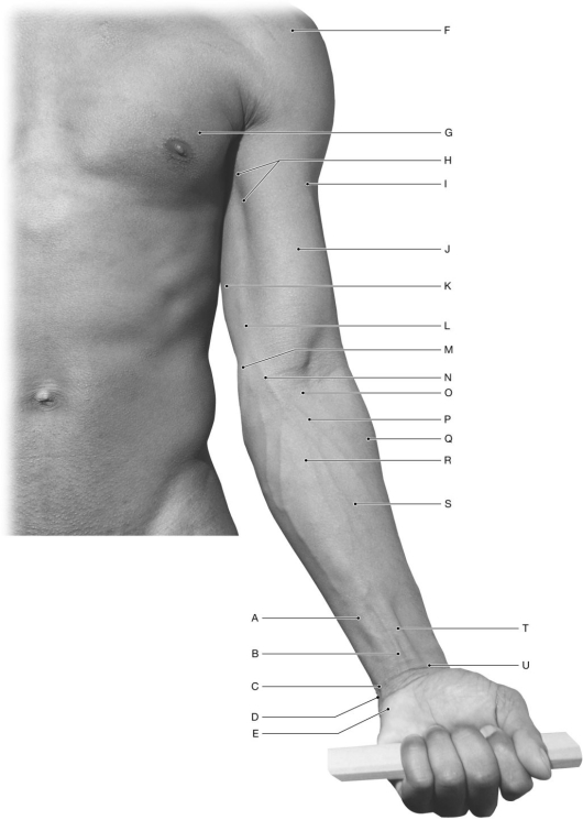 Figure 12.3 Using the figure above, identify the labeled part. -Label I: ______________________________