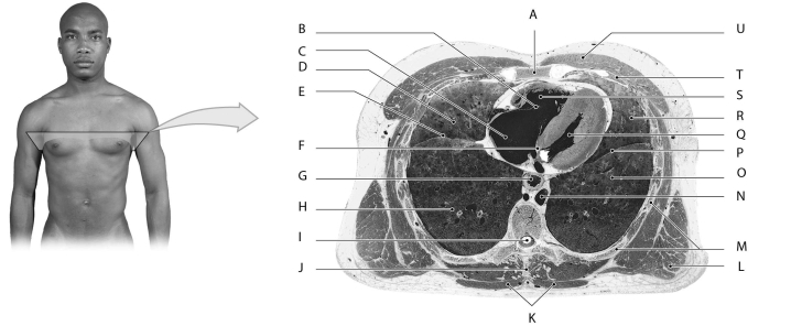 Figure 12.5 Using the figure above, identify the labeled part. -Label L: ______________________________