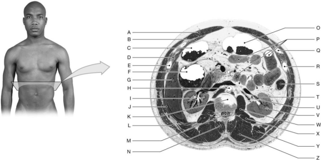 Figure 12.6 Using the figure above, identify the labeled part. -Label K: ______________________________
