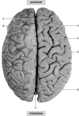 Figure 16.4 Using the figure above, identify the labeled part. -Label C: ______________________________