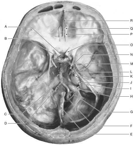 Figure 16.11     Using the figure above, identify the labeled part. -Label H: ______________________________