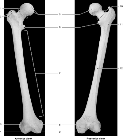 <strong> Figure 8-3 The Femur Use Figure 8-3 to answer the following questions: Identify the structure labeled 12.</strong> A)greater trochanter B)linea aspera C)head D)lateral epicondyle E)lateral condyle