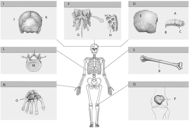 Figure 5.4 Using the above-referenced diagrams of bones classified by shape, identify the specified labeled item in each of the following questions. -Identify the bone type specified by Label I.