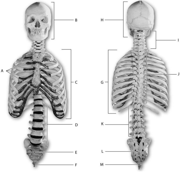 Figure 6.1     Using the above-referenced figures of the anterior (left side)and posterior (right side)views of the axial skeleton, identify the specified labeled part indicated in each of the following questions. -Identify the structure indicated by Label A.