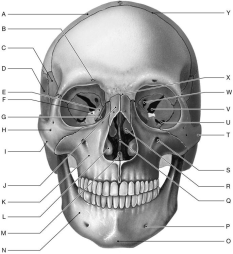 Figure 6.2     Using the above-referenced figure of the anterior view of the bones of the adult skull, identify the specified labeled items in each of the following questions. -Identify the structure indicated by Label N.