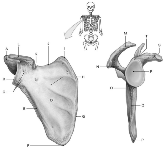 <strong>Figure 7.1 Using the above-referenced figures of the costal (anterior)and lateral views of the scapula, identify the specified labeled part in each of the following questions. Identify the structure indicated by Label O.</strong> A) Spine B) Infraglenoid tubercle C) Coracoid process D) Acromion E) Infraspinous fossa